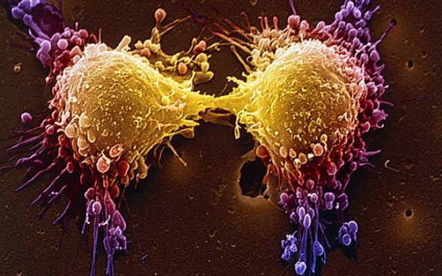 celulas com cancer
